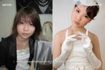 before after