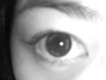 My eye