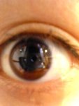 my Eye(s)!