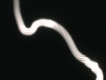 a31