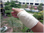 091222 surgery 03