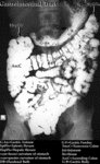 XR Contrast - Gastrointestinal tract