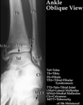 XR - Ankle (Oplique)