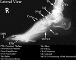 XR - Foot (Lateral)