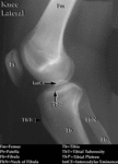 XR - Knee (Lateral)
