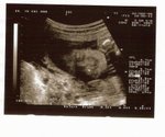 25 Weeks
(1-Sep-05)