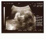 29 Weeks
(29-Sep-05)