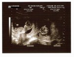 13 Weeks
(7-Jun-05)
