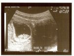 8 Weeks
(7-May-05)