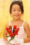 yy0170