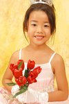 yy0172