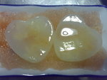 02012007159