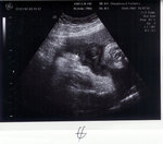 girl 37wk4d