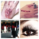 貓眼、淤傷、爛手